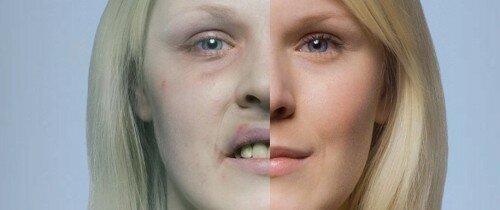 Женщина до и после продолжительного курения